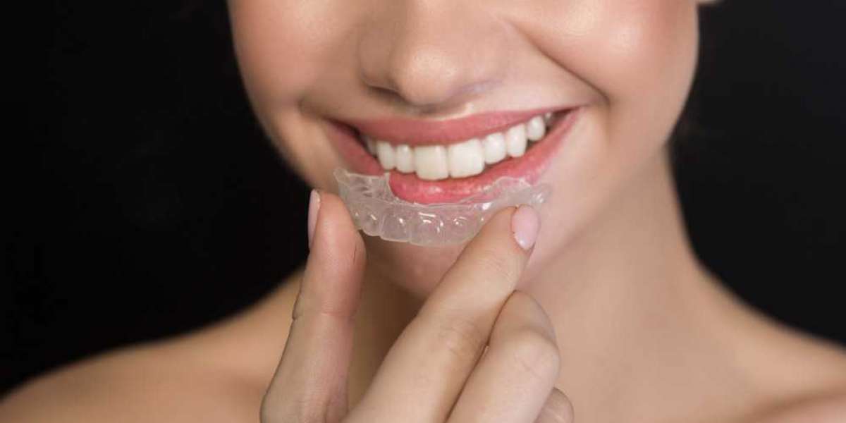 Why Choose Invisalign Aligners for a Discreet Smile Transformation?