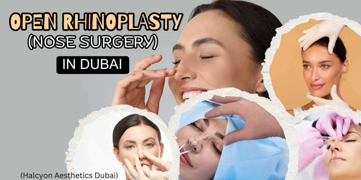 Open Rhinoplasty (Nose Surgery) in Dubai: Enhancing Your Facial Aesthetics with Halcyon Aesthetics Dubai