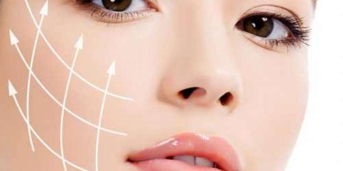 thermage treatment area