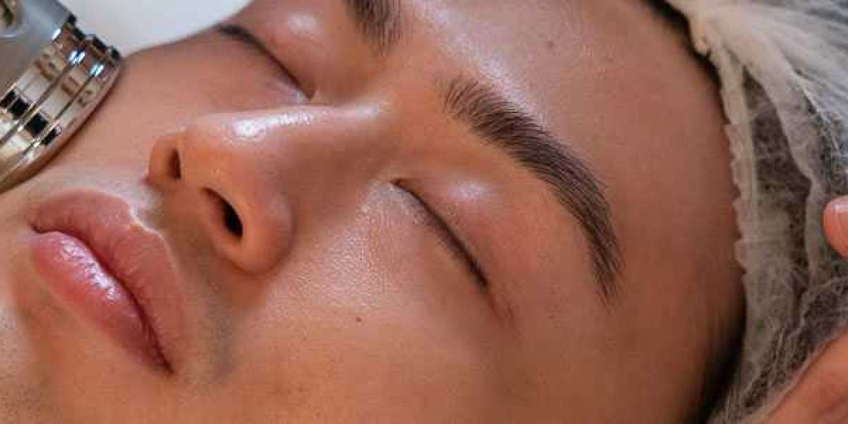 acne facial for men