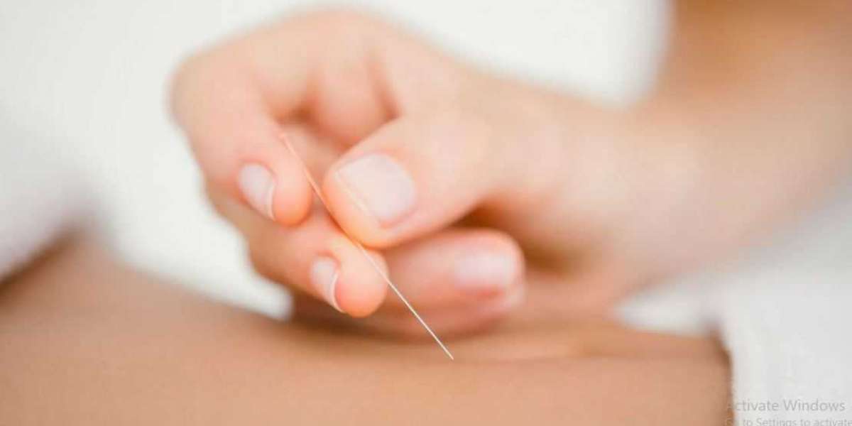 IVF Acupuncture