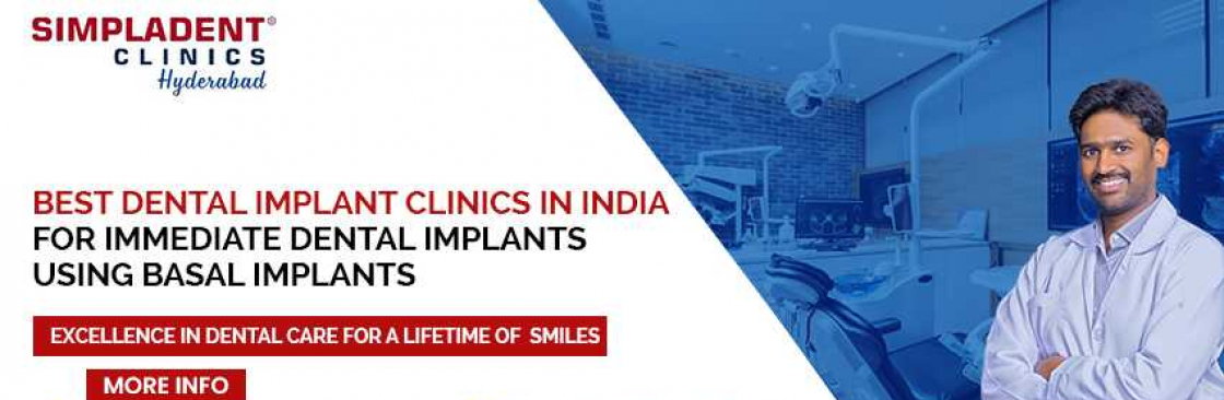 Full Mouth Dental Implant in Hyderabad Cover Image